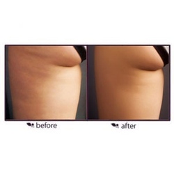 Tarte Cosmetics CelluFight Natural Anti-Cellulite Self-Tanner (2009) 