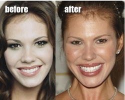 Awful Plastic Surgery: Why, oh Why? 