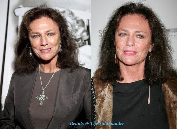 Bisset-before-after-avon.jpg