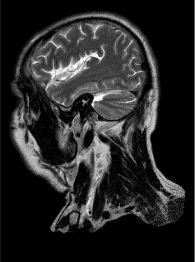 MRI-Maurice-Roucel.jpg