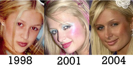 Paris-hilton-nose-jobs.jpg